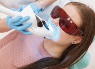 laser teeth whitening