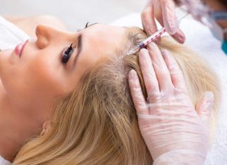 Hair Transplant Tips