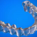 Why Gentle Dentistry Matters for Anxious Children