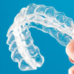 The science behind clear aligners: how do they really work?