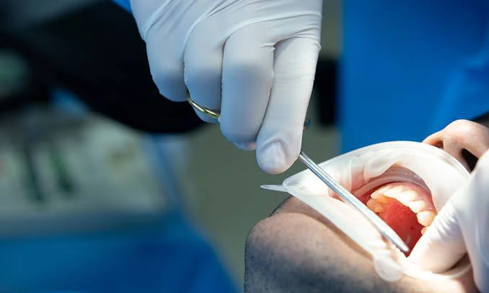 When Is Oral Surgery Really Necessary? Key Signs You Should Never Ignore