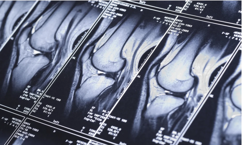 The Role of MRI in Personal Injury Cases: What Attorneys Should Know