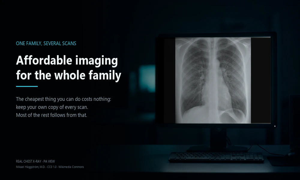 Affordable Medical Imaging Analysis for Families and Multiple Exams