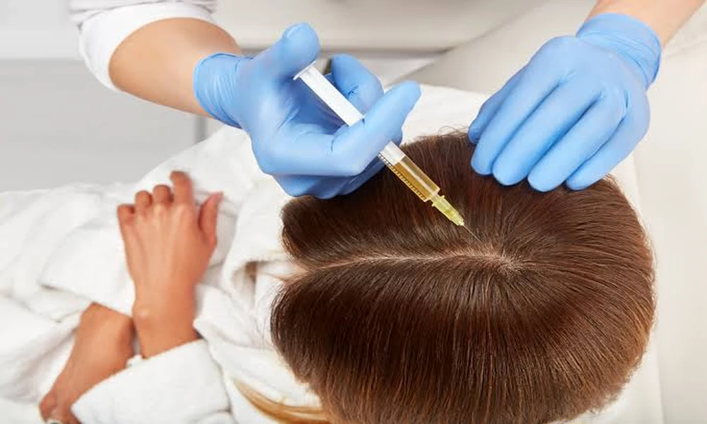 What to Look for When Choosing a Clinic for Hair PRP Therapy