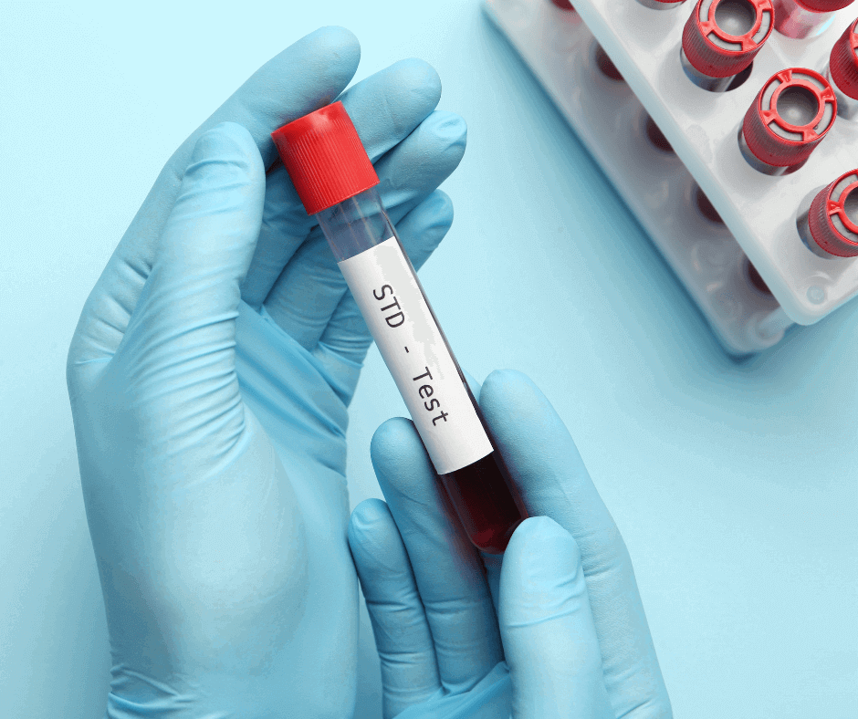 Different Types of STD Tests Explained
