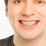 7 Reasons Denture Wearers Switch to Implant-Supported Teeth: Insights From Stubbs Dental and Other Utah Providers